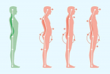 How to Grow Taller at 14: The Role of Stretching in Height Growth